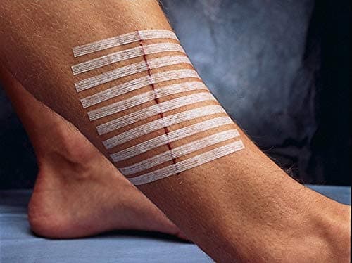 3MSteri-Strip Reinforced Skin Closures, 3mm x 75mm, Pack of 10
