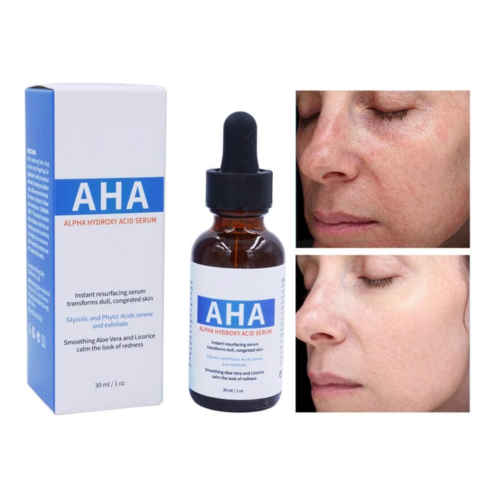 Symeas Glycolic Acid Exfoliation Shrinking Pores Brighten Skin Color Face Serum  Alpha   Hydroxy  Acid for Acne, Oily Skin, Wrinkles, Blackheads, Large Pores,Dull Skin 30ml
