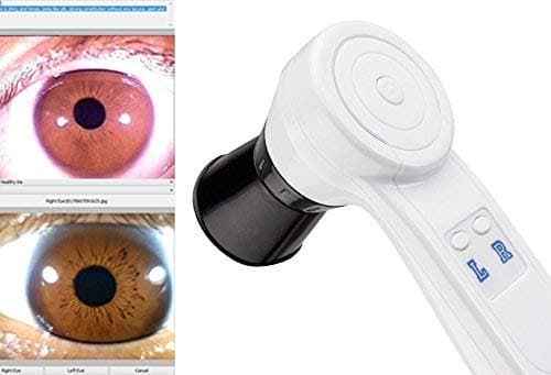 5.0 MP High Resolution CCD USB Iriscope – Eye Camera Iriscope with 30X Iris Lens and Analysis Software