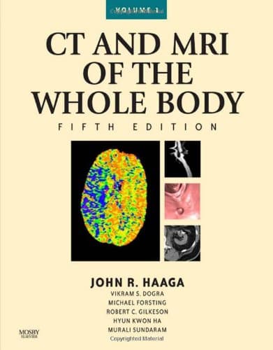 CT and MRI of the Whole Body, 2-Volume Set 5th Edition