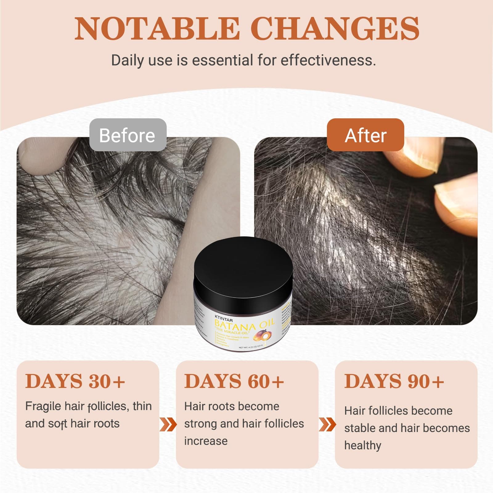 Ktintar 100% Natural Raw Batana Oil for Hair Growth, Unrefined & Organic Dr Sebi Hair Growth Oil From Honduras, Prevents Hair Loss, Eliminates Split Ends 4.23 Fl Oz (Pack of 1)