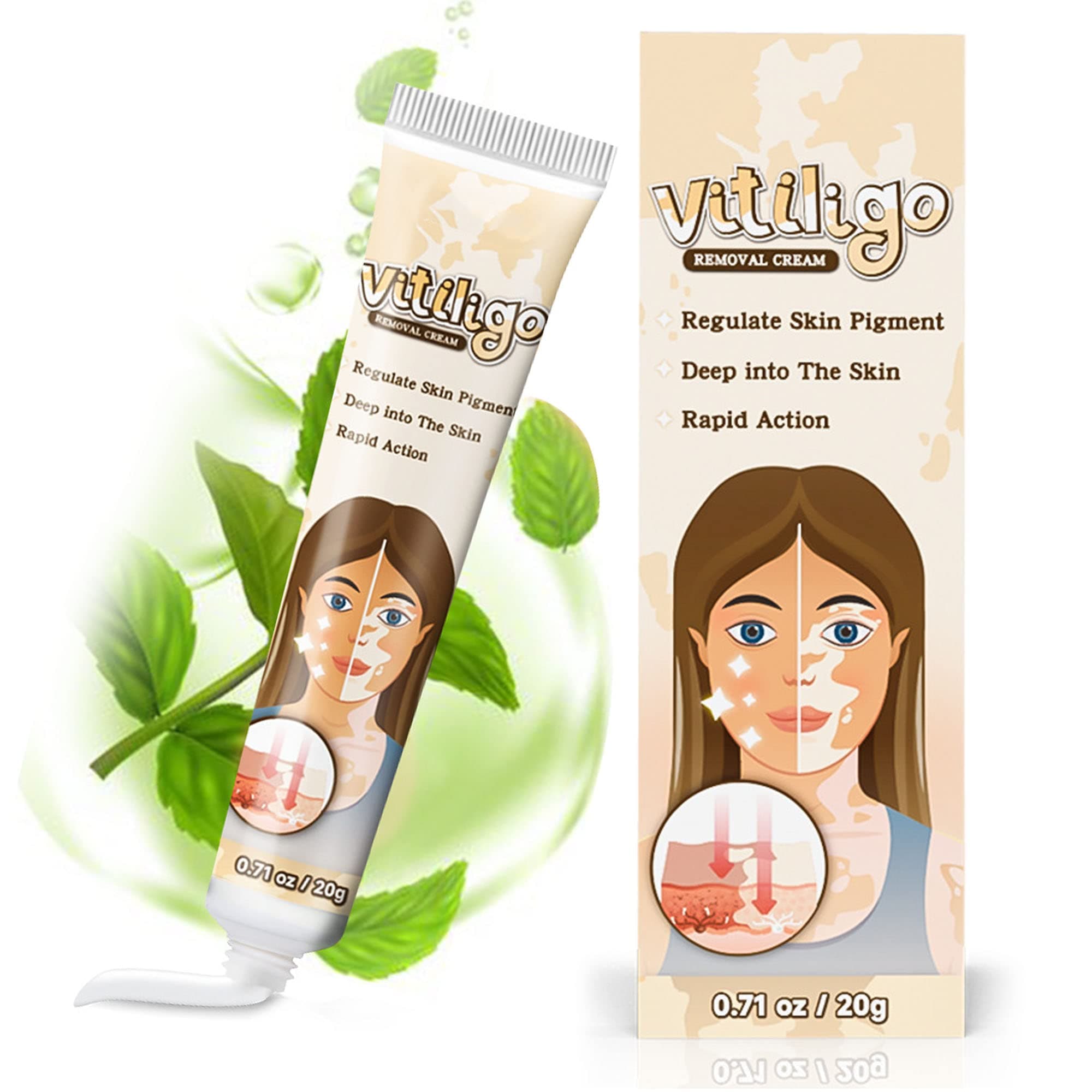 Supwell Vitiligo Cream, Vitiligo Treatment for Skin Vitiligo, Vitiligo Care Cream for Reduce White Spots and Improve Skin Pigmentation